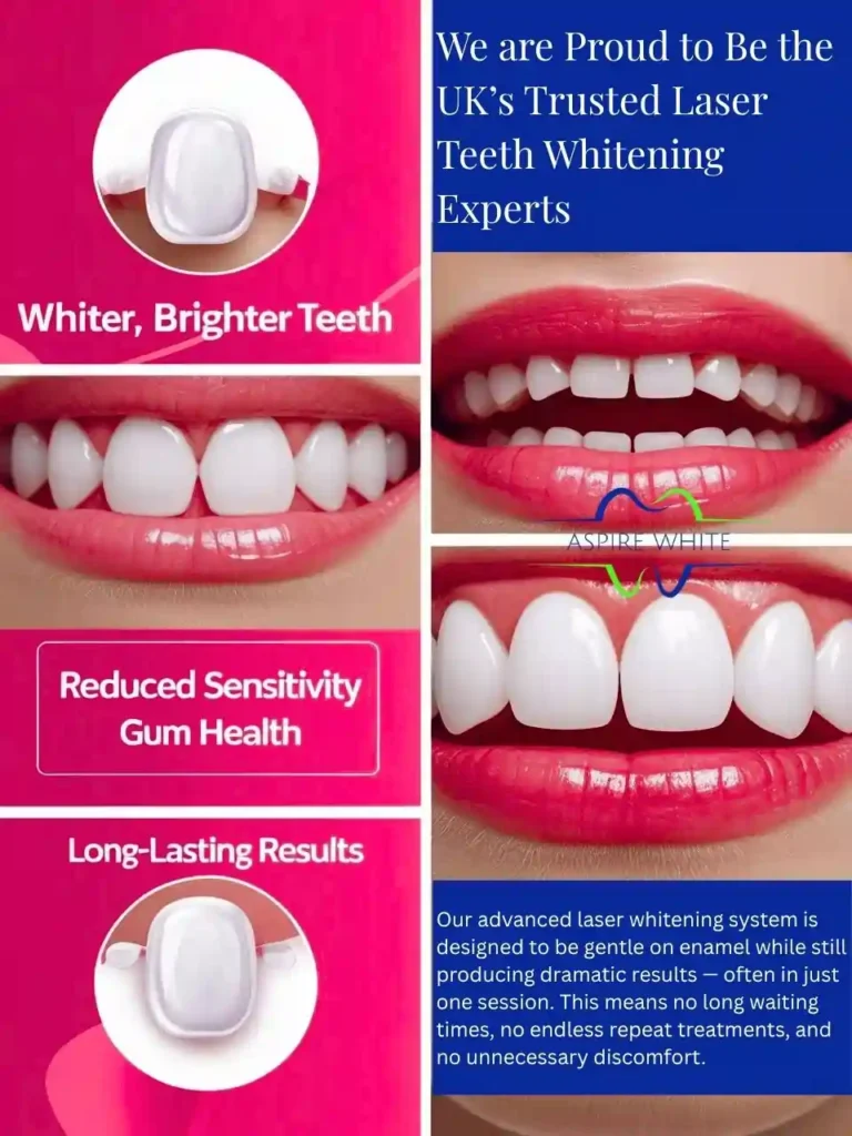 We are Proud to Be the UK’s Trusted Laser Teeth Whitening Experts Enfield Town